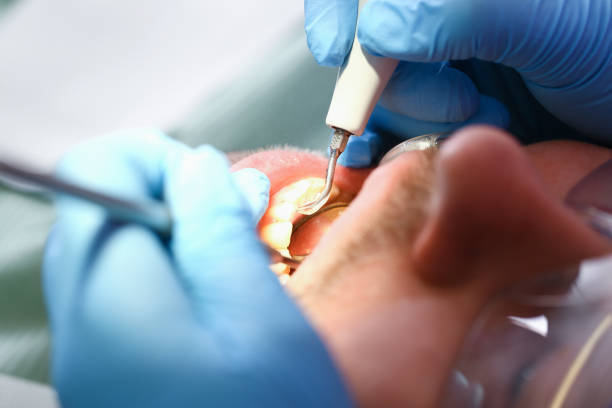 Best Broken or Cracked Tooth Emergency Dentist in Cache, OK