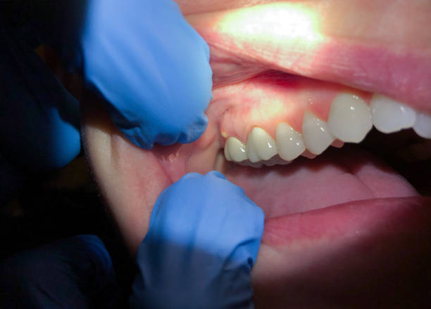 Best Emergency Dentist for Special Needs Patients in Cache, OK
