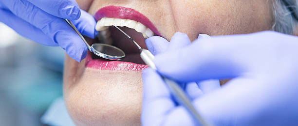 Best Emergency Dentist for Knocked-Out Tooth in Cache, OK